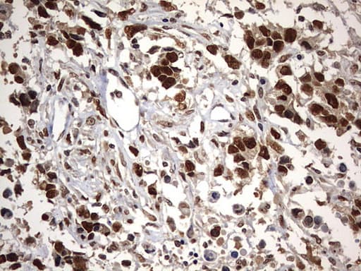 H2AFY2 Antibody (aa2-261, clone OTI1E9)