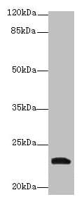 YKT6 Antibody