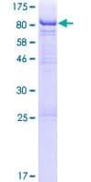 Human THUMPD3 Protein (Recombinant GST)