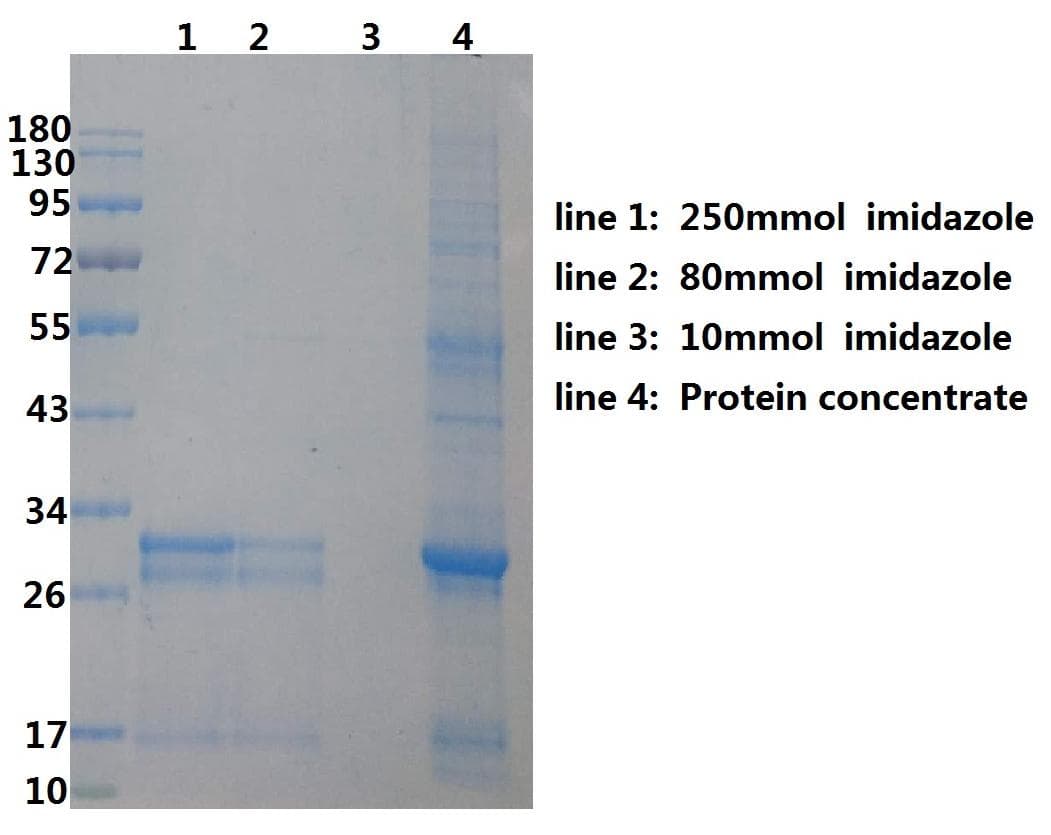 Coronavirus SARS-CoV-2 SARS-CoV-2 Nucleoprotein (Recombinant His,N-terminus)