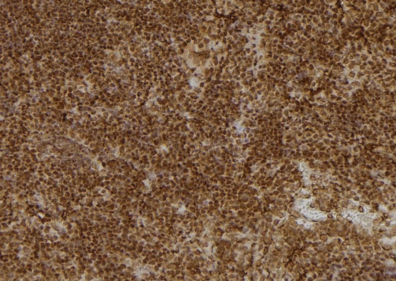 UAP1 Antibody