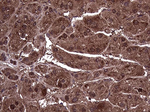 AMDHD1 Antibody (clone OTI5B5, Carrier-free)