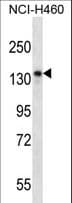 NRD1 / Nardilysin Antibody (aa333-361)