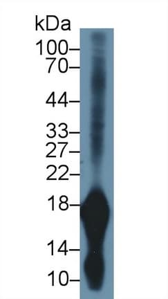 GKN1 / Gastrokine 1 Antibody (aa53-192, Biotin)