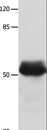 Polyclonal Rabbit anti-Human MUTYH / MYH Antibody (IHC, WB)