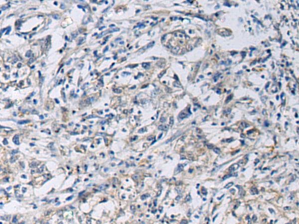 KCNJ10 / SESAME / KIR4.1 Antibody