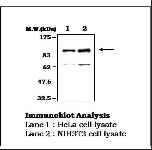 IHC-plus™ PTK2B / PYK2 Antibody