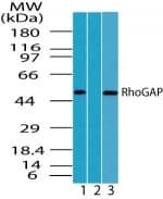 ARHGAP1 / CDC42GAP Antibody (aa1-50)