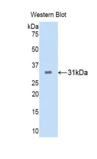 POMC / Proopiomelanocortin Antibody (aa23-267, HRP)