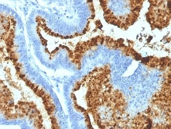 Blood Group B Antibody (clone HEB-20, Azide-free, BSA-free)