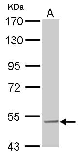 IHC-plus™ Polyclonal Rabbit anti-Human SESN3 Antibody (aa21-296, IHC, WB)