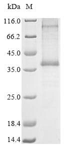 Human C5AR2 / GPR77 / C5L2 Protein (Recombinant 10His, C-terminus)