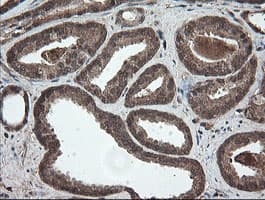 Monoclonal Mouse anti-Human PNPO Antibody (clone OTI1G9, IHC, WB)
