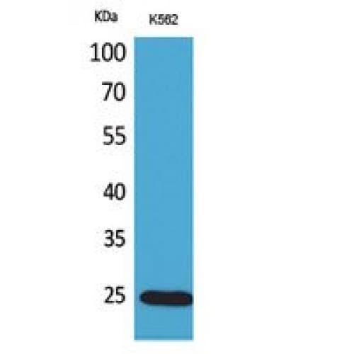 IGFBP6 Antibody (101-150 aa, Internal)
