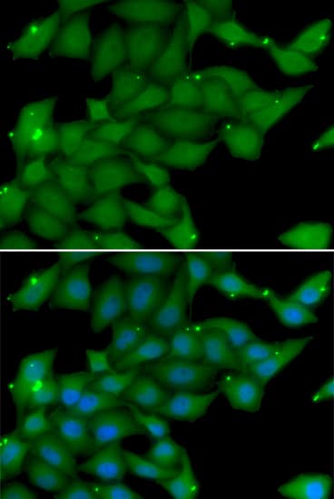 RASGRF1 / CDC25 Antibody
