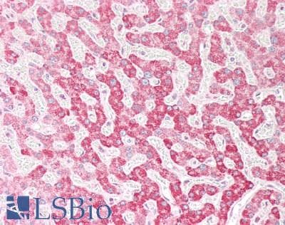 IHC-plus™ OSBPL5 Antibody (aa2-14)