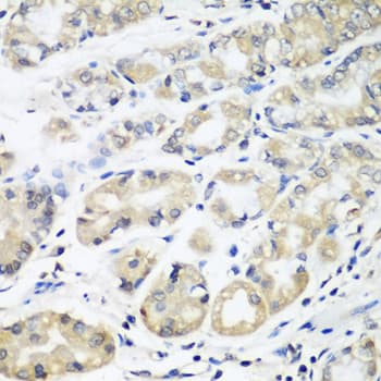 HLA-DMB Antibody