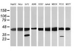 MAP2K1 / MKK1 / MEK1 Antibody (clone OTI1F4)