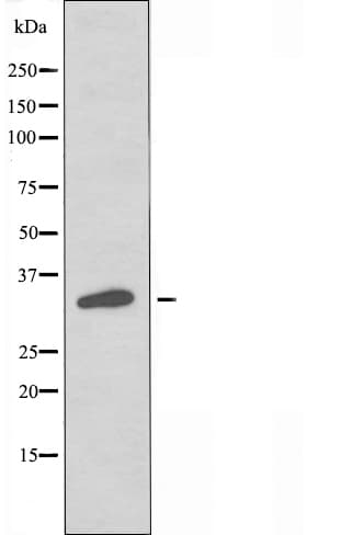 OR56B4 Antibody