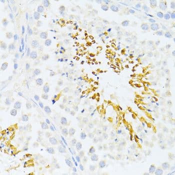 Polyclonal Rabbit anti-Human DDIT3 / CHOP Antibody (IHC, WB)