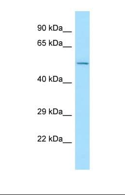 Polyclonal Rabbit anti-Human CNOT6L Antibody (aa242-291, WB)