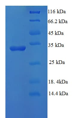 Human UBE2D3 / UBCH5C Protein (Recombinant His-SUMO)