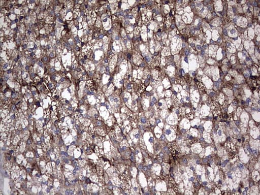 TG / Thyroglobulin Antibody (aa20-358, clone OTI8E8)