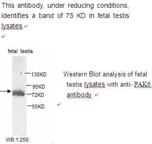 PAK6 Antibody