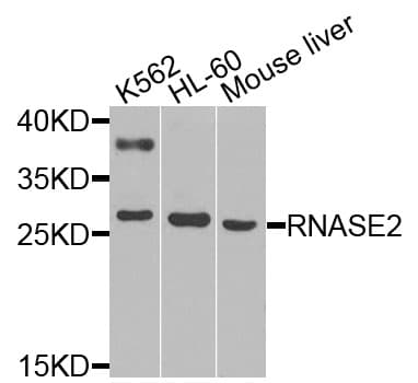 Polyclonal Rabbit anti-Human RNASE2 / EDN Antibody (WB)