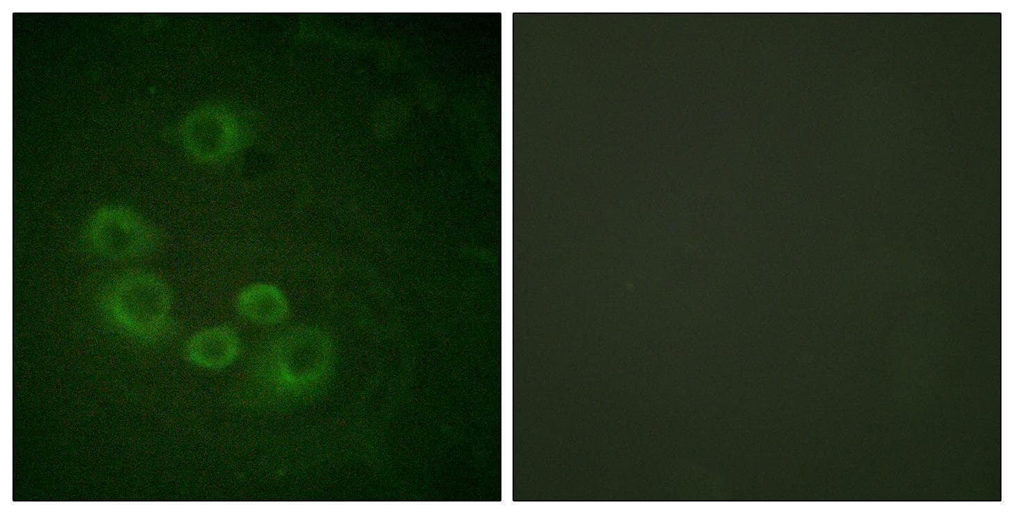 NFKBIA / IKB Alpha / IKBA Antibody (Ab-305)