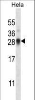 SNRPN Antibody (aa34-62)