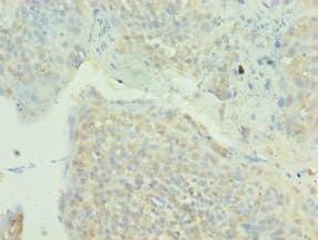 MAPK4 / ERK4 Antibody (aa348-587)