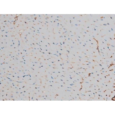 CREB1 / CREB Antibody (phospho-Ser142)
