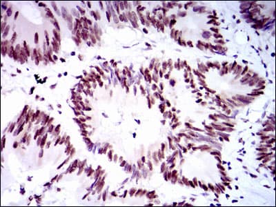RPA70 / RPA1 Antibody (clone 4C4)