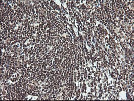 MCTS1 Antibody (aa1-181, clone OTI2F9)
