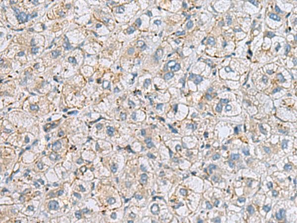 Polyclonal Rabbit anti-Human MTHFD2 Antibody (IHC)