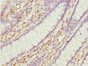 TNRC5 / CNPY3 Antibody