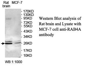 RAB4A / RAB4 Antibody (aa1-213)