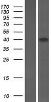 Human SPRED3 Protein (Over-Expression Lysate Myc-DDK (Flag))