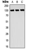ROR2 Antibody (Internal)