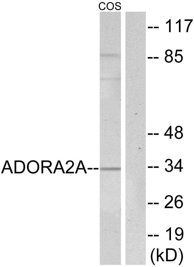 Polyclonal Rabbit anti-Human ADORA2A/Adenosine A2A Receptor Antibody (IHC, IF, WB)