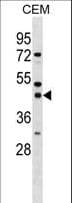 Polyclonal Rabbit anti-Human SSDP1 / SSBP3 Antibody (aa166-192, WB)