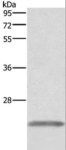Polyclonal Rabbit anti-Human GH / Growth Hormone Antibody (IHC, WB)