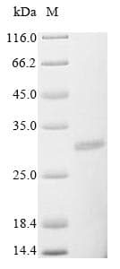 Rotavirus A Non-structural Glycoprotein 4 (Recombinant 6His, N-terminus + Myc, C-terminus)