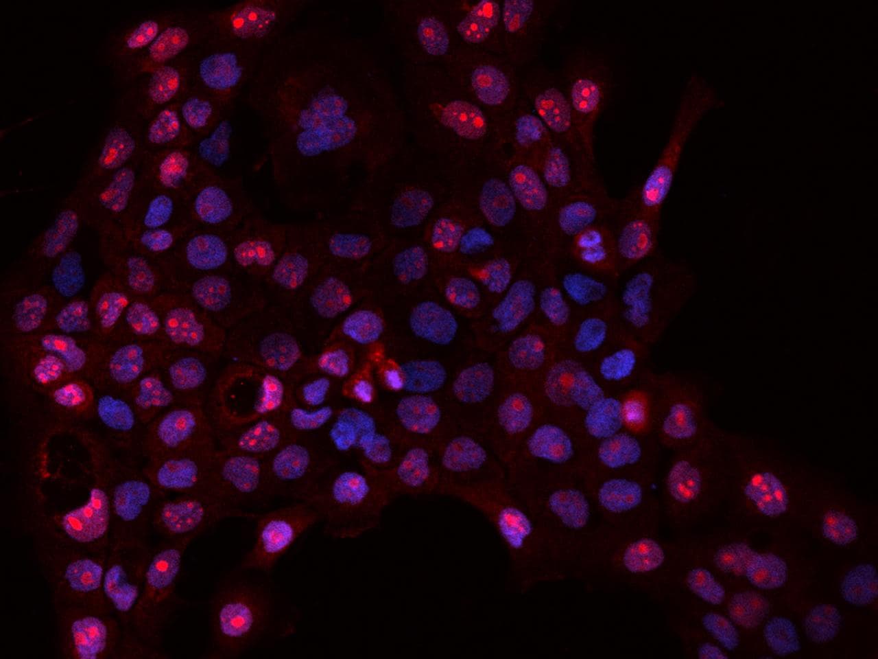 DNTTIP2 Antibody