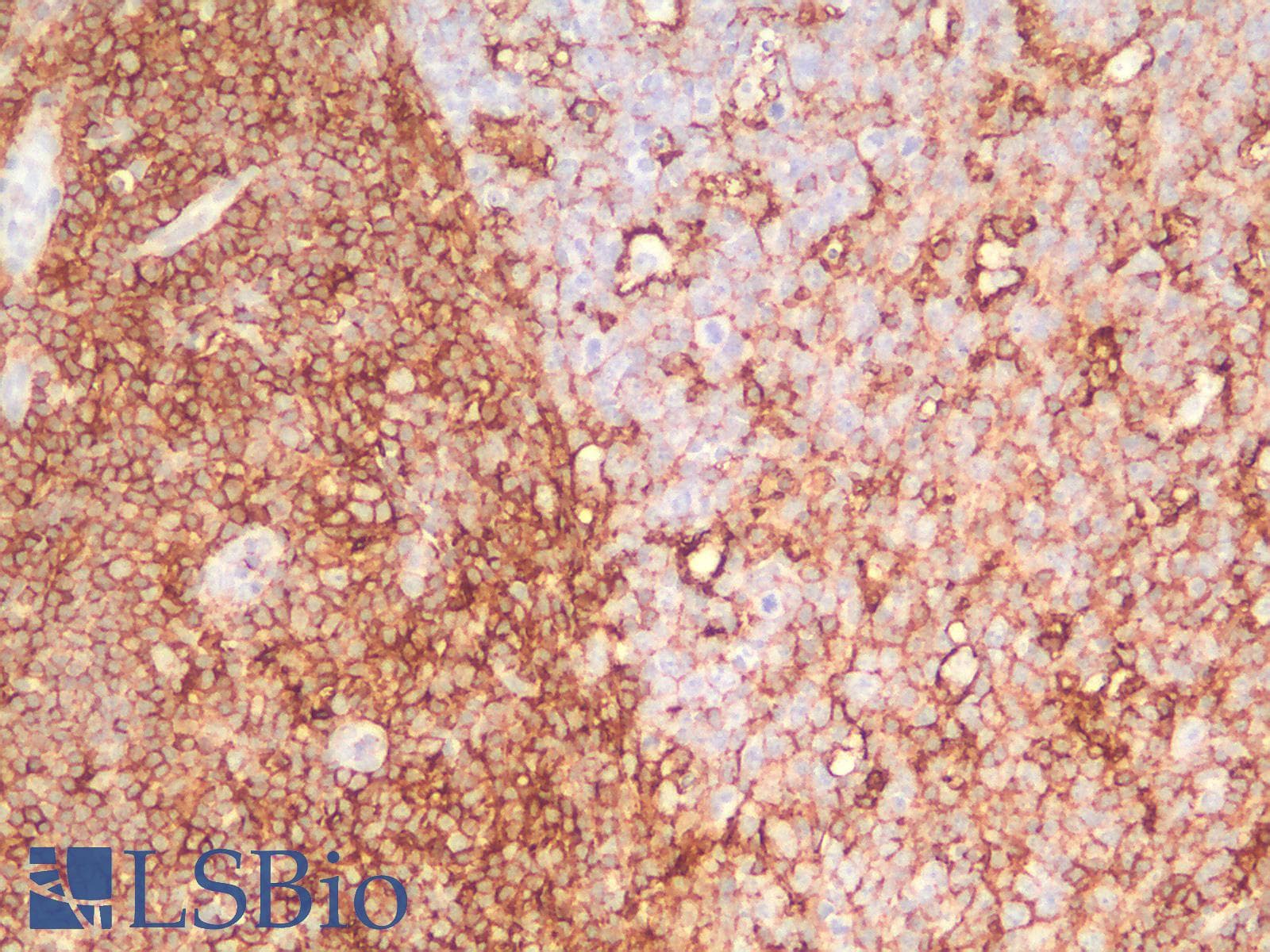 PathPlus™ CD44 Antibody (clone HCAM/2875R)