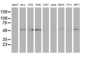 SQSTM1 Antibody (clone OTI4C8)