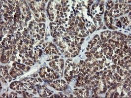 ARMC1 Antibody (clone OTI2G8, Carrier-free)