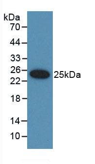 FAT10 / UBD Antibody (aa1-155)
