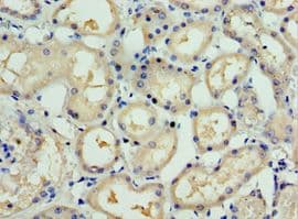 SSX5 Antibody (aa1-229)